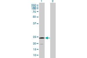 Western Blot analysis of SSR2 expression in transfected 293T cell line by SSR2 MaxPab polyclonal antibody. (SSR2 抗体  (AA 1-186))