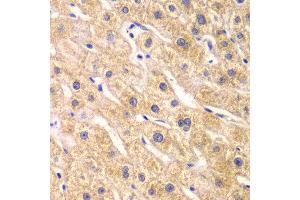 Immunohistochemistry of paraffin-embedded human liver injury using RPS7 antibody at dilution of 1:100 (x40 lens). (RPS7 抗体)