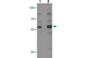 Western blot analysis of PLAGL2 in rat brain tissue with PLAGL2 polyclonal antibody  at (1) 1 and (2) 2 ug/mL. (PLAGL2 抗体  (N-Term))