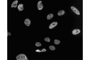 Immunofluorescent staining of HeLa (ATCC CCL-2) cells. (PSME3 抗体  (AA 45-147))