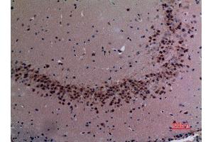 Immunohistochemistry (IHC) image for anti-Staphylococcal Nuclease Domain Containing Protein 1 (SND1) (Internal Region) antibody (ABIN3180975)