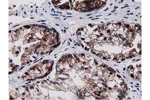 Image no. 1 for anti-Sequestosome 1 (SQSTM1) antibody (ABIN1499988) (SQSTM1 抗体)