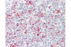 Anti-STEAP2 antibody IHC of human tonsil. (STEAP2 抗体  (Internal Region))
