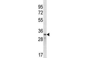 Cyclin D2 antibody western blot analysis in CEM lysate (Cyclin D2 抗体  (AA 1-30))