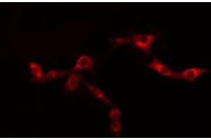 ABIN6276441 staining  SKOV3 cells by IF/ICC. (GRP94 抗体  (C-Term))