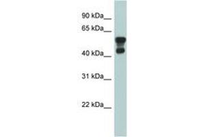 Image no. 1 for anti-Platelet-Activating Factor Acetylhydrolase 1b, Regulatory Subunit 1 (45kDa) (PAFAH1B1) (AA 71-120) antibody (ABIN6743973) (PAFAH1B1 抗体  (AA 71-120))