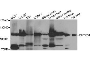 Western blot analysis of extracts of various cell lines, using DHTKD1 antibody. (DHTKD1 抗体)