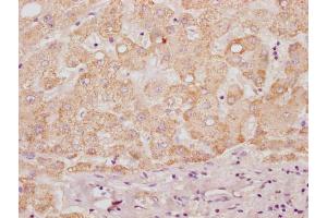 IHC image of ABIN7155014 diluted at 1:100 and staining in paraffin-embedded human liver tissue performed on a Leica BondTM system. (HS3ST3B1 抗体  (AA 54-390))