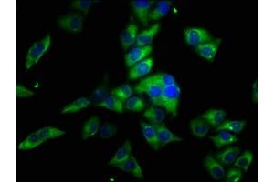 Immunofluorescence staining of Hela cells with ABIN7162115 at 1:33, counter-stained with DAPI. (Obscurin 抗体  (AA 1621-1712))