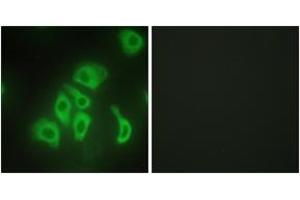 Immunofluorescence analysis of HepG2 cells, using TNFA Antibody. (TNF alpha 抗体  (AA 141-190))