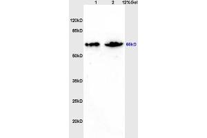 L1 rat brain lysates L2 mouse intestine lysates probed with Anti ZNF300 Polyclonal Antibody, Unconjugated (ABIN671091) at 1:200 overnight at 4 °C. (ZNF300 抗体  (AA 165-250))