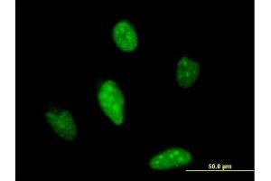 Immunofluorescence of monoclonal antibody to ATOH1 on HeLa cell. (ATOH1 抗体  (AA 266-354))