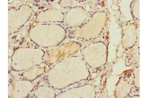 Immunohistochemistry of paraffin-embedded human thyroid tissue using ABIN7168009 at dilution of 1:100 (RHOBTB1 抗体  (AA 240-400))