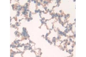 Used in DAB staining on fromalin fixed paraffin- embedded Kidney tissue (CD97 抗体  (AA 191-304))