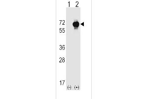 Western Blotting (WB) image for anti-serine threonine Kinase 39 (STK39) (AA 346-376) antibody (ABIN392497)