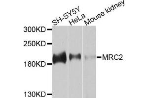 Western blot analysis of extracts of various cells, using MRC2 antibody. (MRC2 抗体)