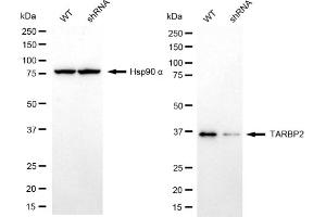 Western blotting analysis using TARBP2 antibody (ABIN7800510). (Recombinant TARBP2 抗体)