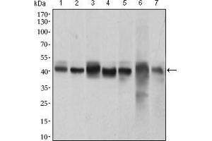 Western blot analysis using MAPK14 mouse mAb against HeLa (1), NIH/3T3 (2), Jurkat (3), Raw264.