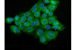 IF analysis of NSE using anti-NSE antibody (ABIN6719549). (ENO2/NSE 抗体)