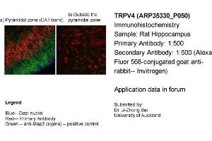 Immunohistochemistry (IHC) image for anti-Transient Receptor Potential Cation Channel, Subfamily V, Member 4 (TRPV4) (Middle Region) antibody (ABIN2776240) (TRPV4 抗体  (Middle Region))