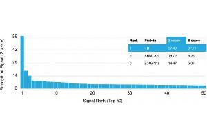 Analysis of Protein Array containing more than 19,000 full-length human proteins using CD117 Mouse Monoclonal Antibody (KIT/2670). (KIT 抗体)