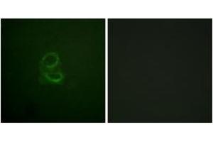 Immunofluorescence analysis of A549 cells, using IL-4R/CD124 (Ab-497) Antibody. (IL4 Receptor 抗体  (AA 463-512))