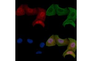 ABIN6255699 and ABIN6267466 staining Hela cells by IF/ICC. (CDC25A 抗体  (pThr507))