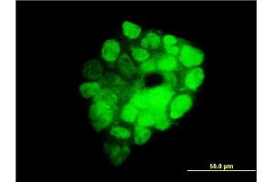 Immunofluorescence of monoclonal antibody to ITGB3BP on A-431 cell. (ITGB3BP 抗体  (AA 1-100))