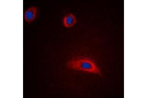 Immunofluorescent analysis of GAP43 staining in HeLa cells. (GAP43 抗体  (N-Term))