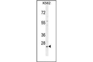 Western blot analysis of MCART2 Antibody (N-term) in K562 cell line lysates (35ug/lane). (MCART2 抗体  (N-Term))