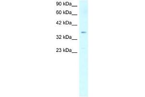 SCD antibody used at 1 ug/ml to detect target protein. (SCD 抗体)
