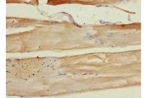 Immunohistochemistry of paraffin-embedded human skeletal muscle tissue using ABIN7149412 at dilution of 1:100 (PLA2G4C 抗体  (AA 1-189))