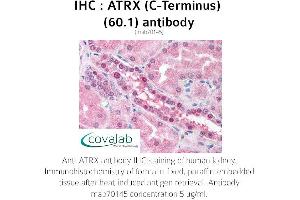 Image no. 1 for anti-RAD54-Like (RAD54L) (AA 1-300) antibody (ABIN1723093) (RAD54L 抗体  (AA 1-300))