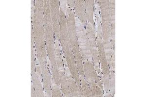 Immunohistochemical analysis of A on paraffin-embedded Human skeletal muscle tissue. (RAPTOR 抗体  (pSer863))