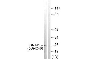 Western blot analysis of extracts from HT29 cells, using SNAI1 (Phospho-Ser246) antibody. (SNAIL 抗体  (pSer246))