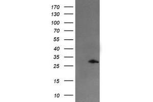 Image no. 1 for anti-Snail Family Zinc Finger 2 (SNAI2) antibody (ABIN1502651) (SLUG 抗体)