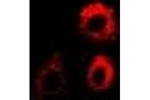 Immunofluorescent analysis of PTRH2 staining in MCF7 cells. (PTRH2 抗体)