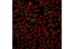 Immunofluorescence (IF) image for anti-CD86 (CD86) antibody (ABIN6941141)