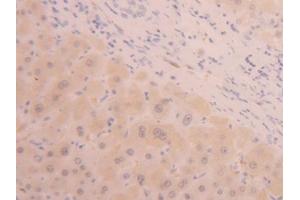 IHC-P analysis of Human Liver Tissue, with DAB staining. (ALT 抗体  (AA 367-480))
