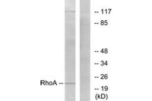 Western blot analysis of extracts from HepG2 cells, using RhoA (Ab-188) Antibody. (RHOA 抗体  (AA 144-193))