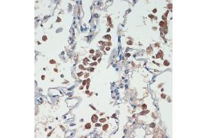 Immunohistochemistry of paraffin-embedded human lung using APC antibody (ABIN1678689, ABIN1678690, ABIN5664154 and ABIN6219837) at dilution of 1:200 (40x lens). (APC 抗体  (AA 2544-2843))