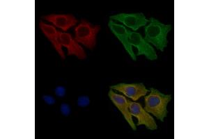 ABIN6257296 and ABIN6275747 staining Hela cells by IF/ICC. (TAO Kinase 3 抗体  (Internal Region))