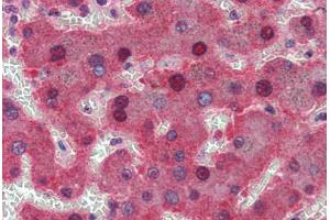 Human Liver: Formalin-Fixed, Paraffin-Embedded (FFPE) (c-MYC 抗体  (AA 408-439))