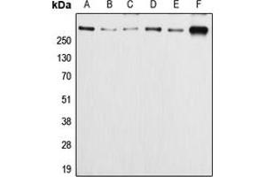 Western blot analysis of APC (pS2054) expression in HeLa (A), Caco2 (B), SW480 (C), MCF7 (D), SP2/0 (E), PC12 (F) whole cell lysates. (APC 抗体  (pSer2054))