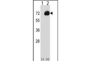 Western blot analysis of CTPS2 (arrow) using rabbit polyclonal CTPS2 Antibody (C-term) (ABIN656954 and ABIN2846140). (CTPS2 抗体  (C-Term))