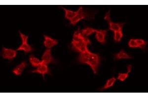 ABIN6268846 staining HT29 by IF/ICC. (TANK 抗体  (Internal Region))