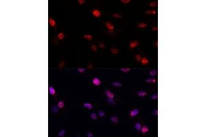 Immunofluorescence analysis of C6 cells using BRC antibody (1318) at dilution of 1:100. (BRCA1 抗体  (AA 400-699))