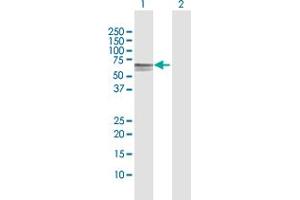 Western Blot analysis of DOK1 expression in transfected 293T cell line by DOK1 MaxPab polyclonal antibody. (DOK1 抗体  (AA 1-481))