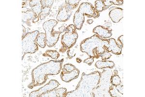 Immunohistochemistry (IHC) image for anti-Epidermal Growth Factor Receptor (EGFR) (AA 1100-1150) antibody (ABIN7795640)