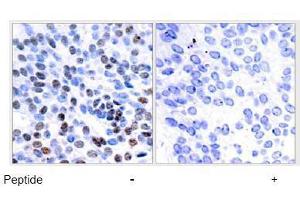 Image no. 1 for anti-Jun B Proto-Oncogene (JUNB) (Ser259) antibody (ABIN197141) (JunB 抗体  (Ser259))